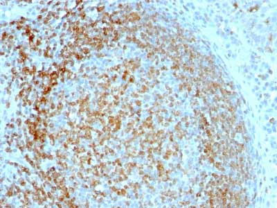 Immunohistochemistry (Formalin/PFA-fixed paraffin-embedded sections) - Anti-CD74 antibody [LN-2] - BSA and Azide free (AB213104)
