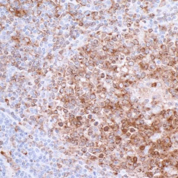 Immunohistochemistry (Formalin/PFA-fixed paraffin-embedded sections) - Anti-CD74 antibody [LN2] (AB265584)