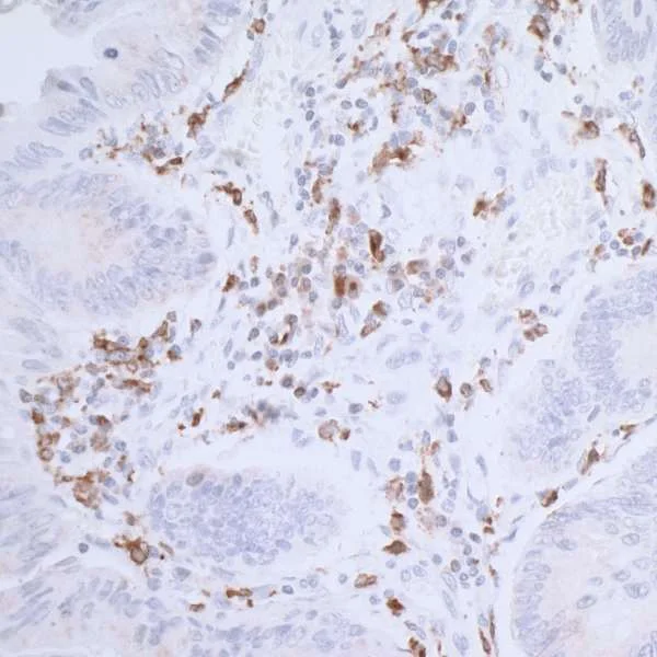 Immunohistochemistry (Formalin/PFA-fixed paraffin-embedded sections) - Anti-CD74 antibody [LN2] (AB265584)