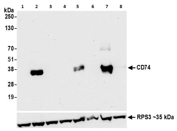 Western blot - Anti-CD74 antibody [LN2] (AB265584)