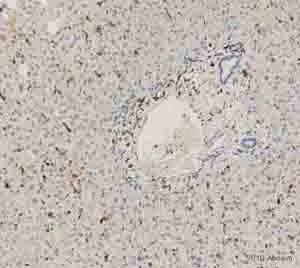 Immunohistochemistry (Formalin/PFA-fixed paraffin-embedded sections) - Anti-CD74 antibody [LN2] (AB9514)