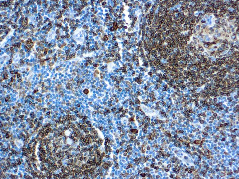 Immunohistochemistry (Formalin/PFA-fixed paraffin-embedded sections) - Anti-CD74 antibody [LN2] (AB9514)