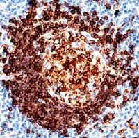 Immunohistochemistry (Formalin/PFA-fixed paraffin-embedded sections) - Anti-CD74 antibody [LN2] (AB9514)