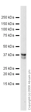 Western blot - Anti-CD74 antibody [LN2] (AB9514)