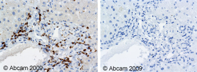 Immunohistochemistry (Formalin/PFA-fixed paraffin-embedded sections) - Anti-CD74 antibody [PIN.1] (AB22603)