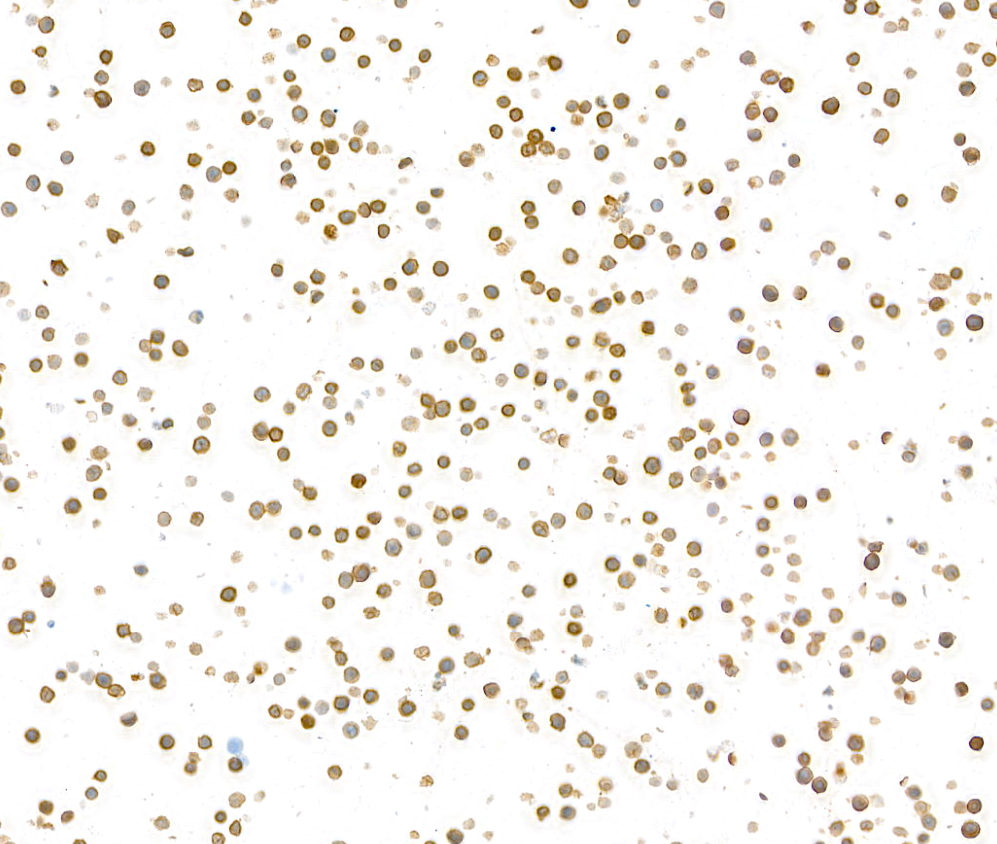 Immunocytochemistry - Anti-CD79A antibody [BLR234K] - BSA free (ab314053), expandable thumbnail