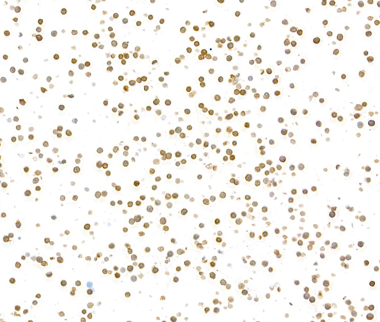 Immunocytochemistry - Anti-CD79A antibody [BLR234K] - BSA free (AB314053)