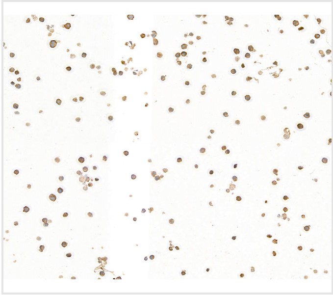 Immunocytochemistry - Anti-CD79A antibody [BLR234K] - BSA free (ab314053), expandable thumbnail
