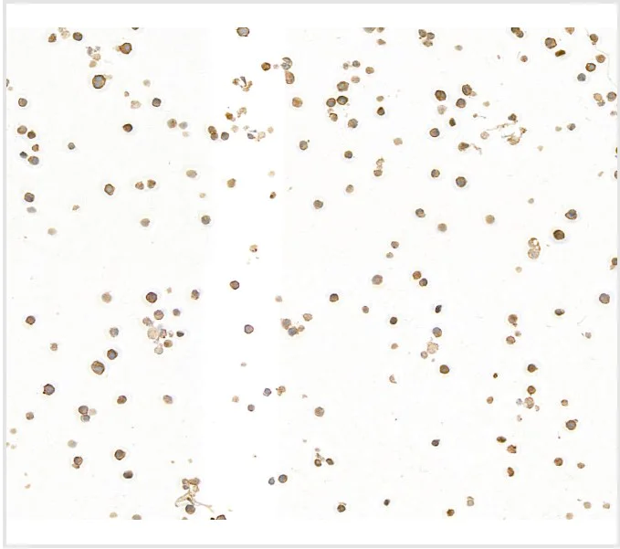 Immunocytochemistry - Anti-CD79A antibody [BLR234K] - BSA free (AB314053)