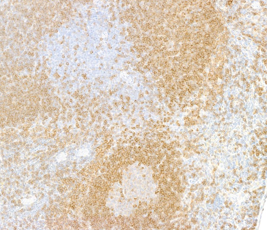 Immunohistochemistry (Formalin/PFA-fixed paraffin-embedded sections) - Anti-CD79A antibody [BLR234K] - BSA free (ab314053), expandable thumbnail