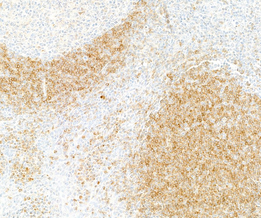 Immunohistochemistry - Anti-CD79A antibody [BLR234K] - BSA free (ab314053), expandable thumbnail