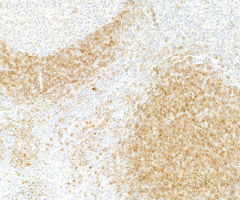 Immunohistochemistry - Anti-CD79A antibody [BLR234K] - BSA free (AB314053)