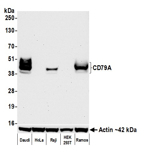 Western blot - Anti-CD79A antibody [BLR234K] - BSA free (AB314053), expandable thumbnail