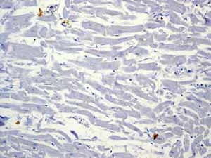 Immunohistochemistry (Formalin/PFA-fixed paraffin-embedded sections) - Anti-CD79a antibody [EP3618] (AB79414)