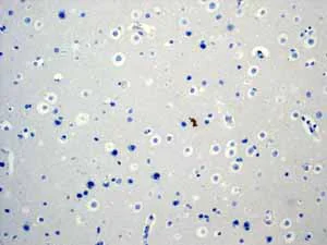 Immunohistochemistry (Formalin/PFA-fixed paraffin-embedded sections) - Anti-CD79a antibody [EP3618] (AB79414)