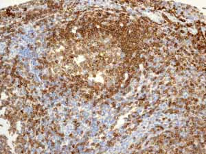 Immunohistochemistry (Formalin/PFA-fixed paraffin-embedded sections) - Anti-CD79a antibody [EP3618] (AB79414)