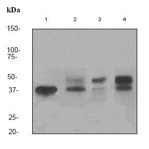 Western blot - Anti-CD79a antibody [EP3618] (AB79414)
