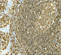 Immunohistochemistry (Formalin/PFA-fixed paraffin-embedded sections) - Anti-CD79a antibody [EP3618] - BSA and Azide free (AB239891), expandable thumbnail