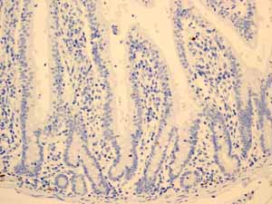 Immunohistochemistry (Formalin/PFA-fixed paraffin-embedded sections) - Anti-CD79a antibody [EP3618] - BSA and Azide free (ab239891), expandable thumbnail