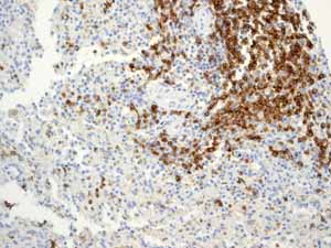 Immunohistochemistry (Formalin/PFA-fixed paraffin-embedded sections) - Anti-CD79a antibody [EP3618] - BSA and Azide free (ab239891), expandable thumbnail