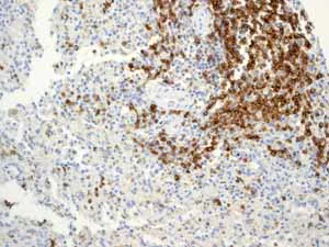 Immunohistochemistry (Formalin/PFA-fixed paraffin-embedded sections) - Anti-CD79a antibody [EP3618] - BSA and Azide free (AB239891)