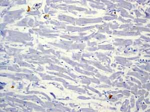 Immunohistochemistry (Formalin/PFA-fixed paraffin-embedded sections) - Anti-CD79a antibody [EP3618] - BSA and Azide free (ab239891), expandable thumbnail