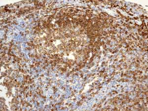 Immunohistochemistry (Formalin/PFA-fixed paraffin-embedded sections) - Anti-CD79a antibody [EP3618] - BSA and Azide free (AB239891), expandable thumbnail