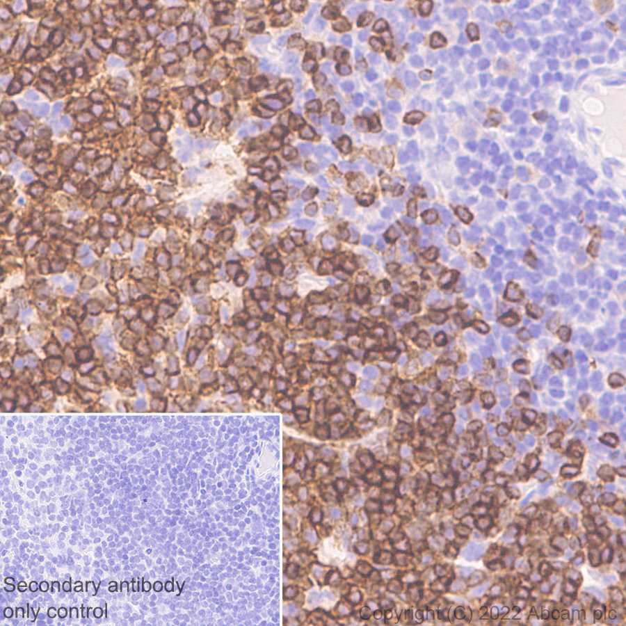 Immunohistochemistry (Formalin/PFA-fixed paraffin-embedded sections) - Anti-CD79a antibody [EPR26537-114] (ab300150), expandable thumbnail