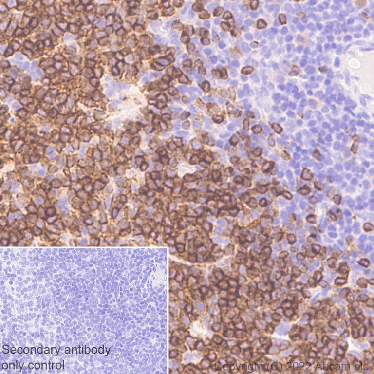 Immunohistochemistry (Formalin/PFA-fixed paraffin-embedded sections) - Anti-CD79a antibody [EPR26537-114] (AB300150)
