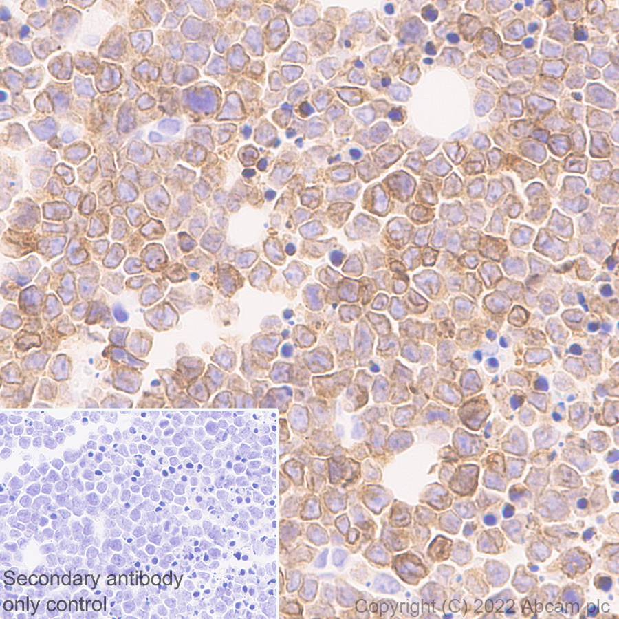 Immunohistochemistry (Formalin/PFA-fixed paraffin-embedded sections) - Anti-CD79a antibody [EPR26537-114] (ab300150), expandable thumbnail