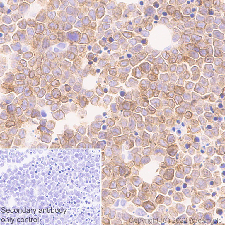 Immunohistochemistry (Formalin/PFA-fixed paraffin-embedded sections) - Anti-CD79a antibody [EPR26537-114] (AB300150)