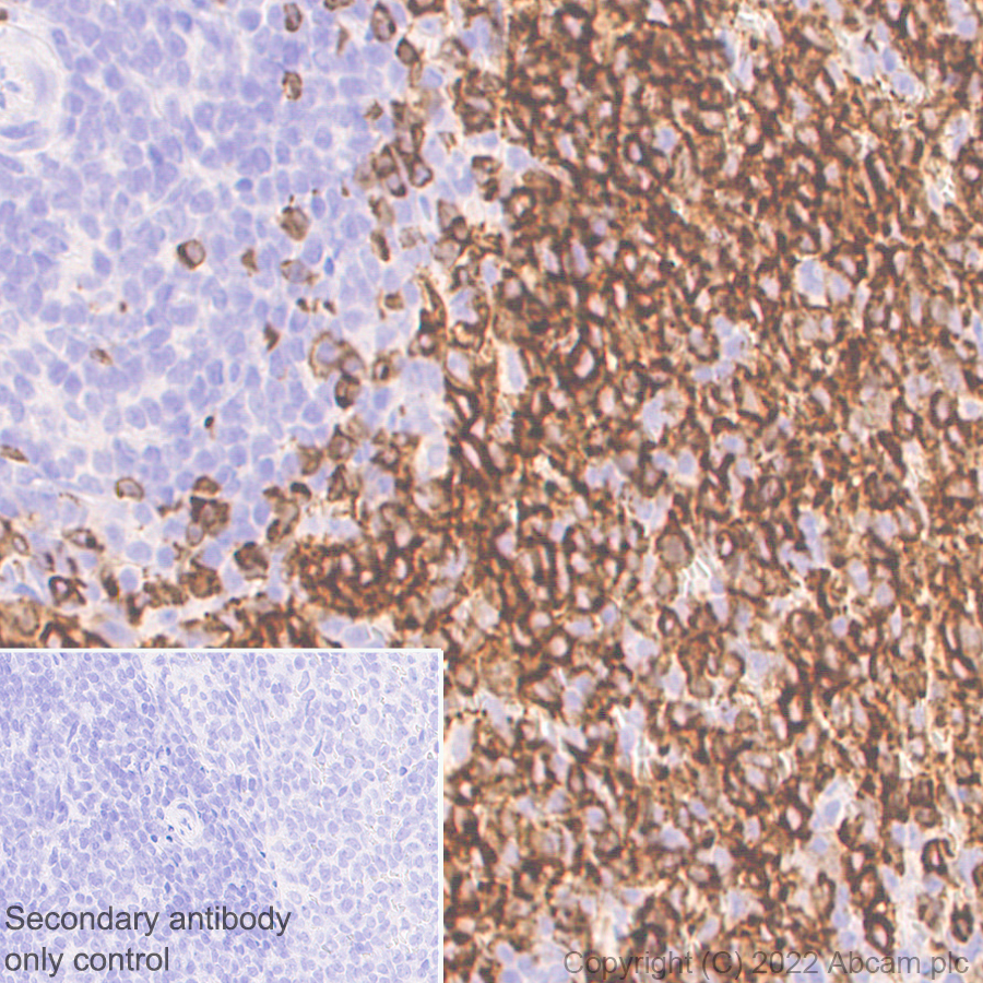 Immunohistochemistry (Formalin/PFA-fixed paraffin-embedded sections) - Anti-CD79a antibody [EPR26537-114] (ab300150), expandable thumbnail