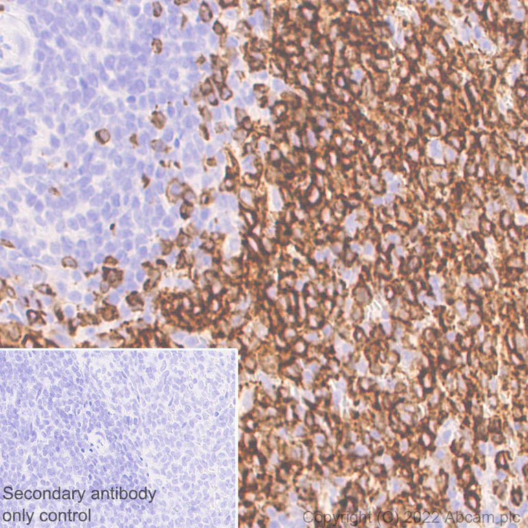 Immunohistochemistry (Formalin/PFA-fixed paraffin-embedded sections) - Anti-CD79a antibody [EPR26537-114] (AB300150)