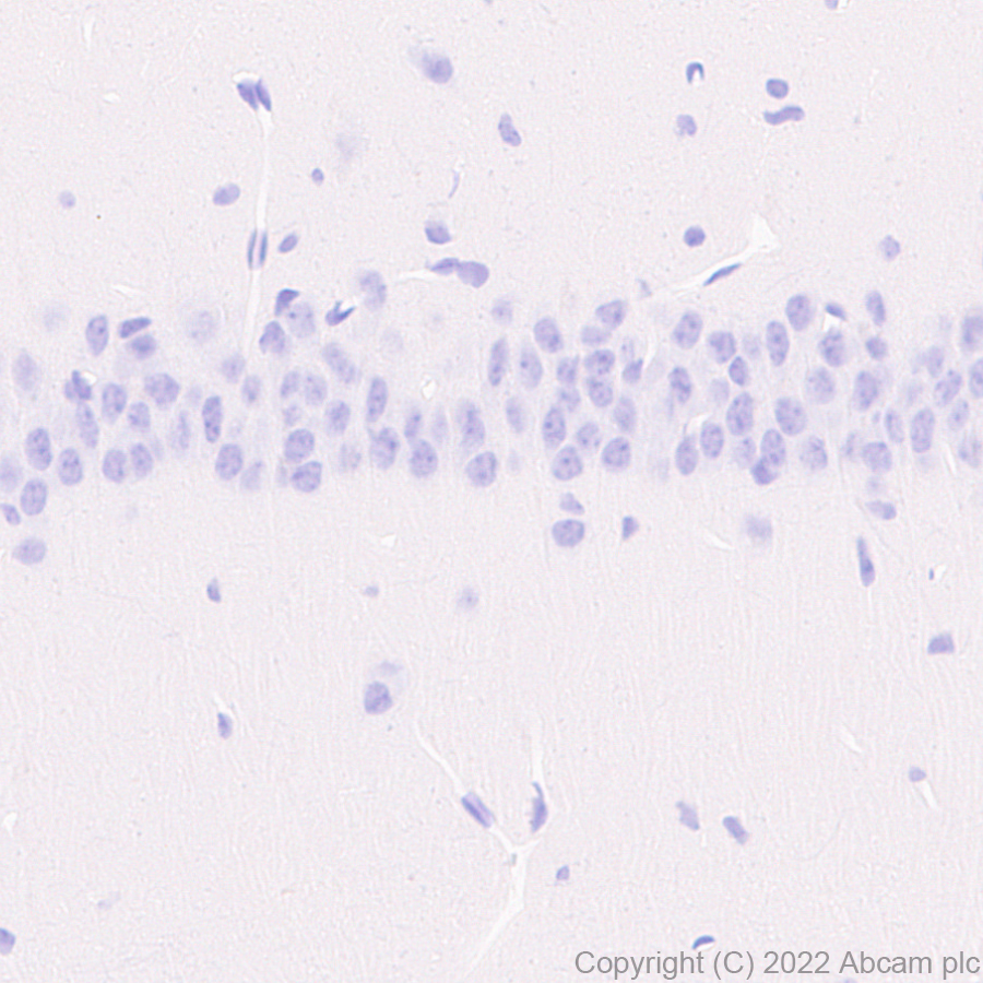 Immunohistochemistry (Formalin/PFA-fixed paraffin-embedded sections) - Anti-CD79a antibody [EPR26537-114] (ab300150), expandable thumbnail