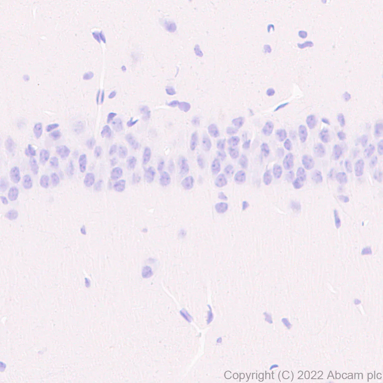 Immunohistochemistry (Formalin/PFA-fixed paraffin-embedded sections) - Anti-CD79a antibody [EPR26537-114] (AB300150)