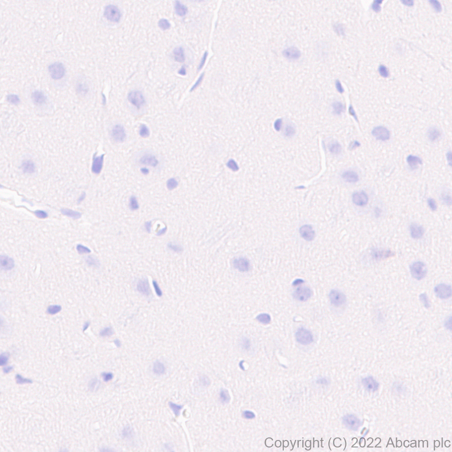 Immunohistochemistry (Formalin/PFA-fixed paraffin-embedded sections) - Anti-CD79a antibody [EPR26537-114] (ab300150), expandable thumbnail