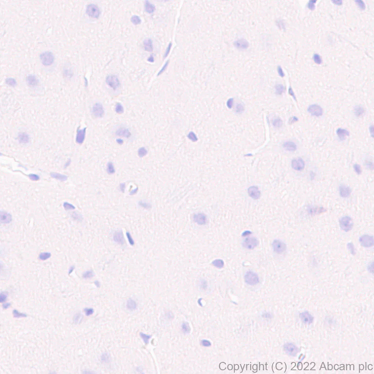 Immunohistochemistry (Formalin/PFA-fixed paraffin-embedded sections) - Anti-CD79a antibody [EPR26537-114] (AB300150)