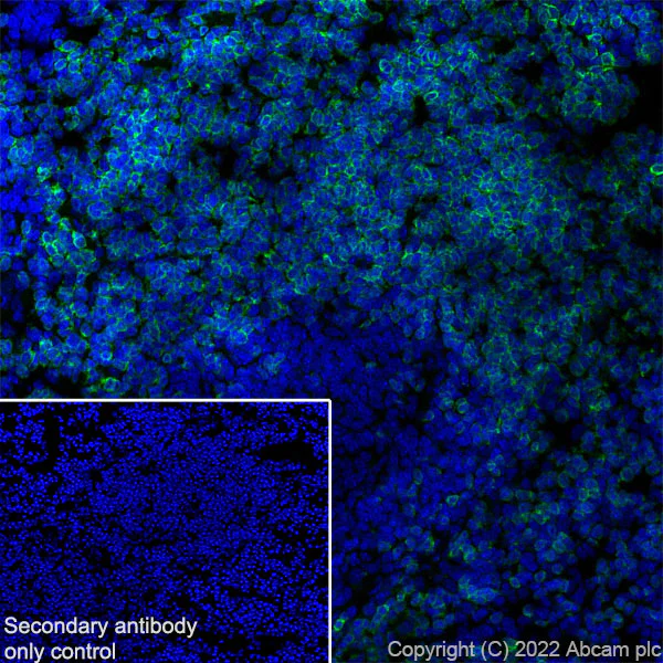Immunohistochemistry (Frozen sections) - Anti-CD79a antibody [EPR26537-114] (AB300150)