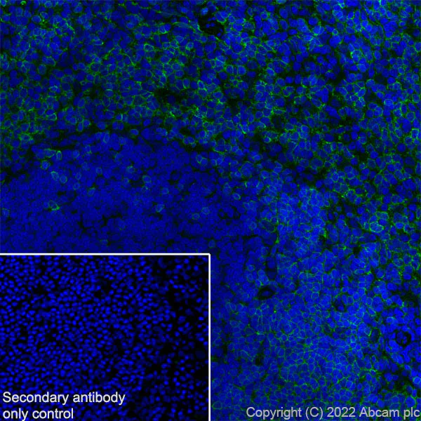Immunohistochemistry (Frozen sections) - Anti-CD79a antibody [EPR26537-114] (AB300150)