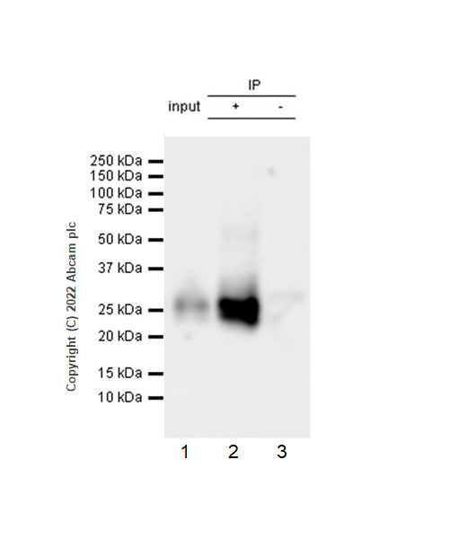Immunoprecipitation - Anti-CD79a antibody [EPR26537-114] (AB300150), expandable thumbnail