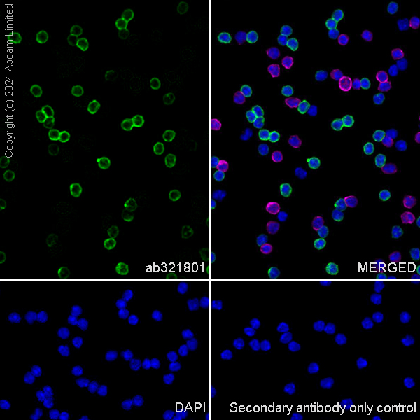 Anti-CD79a antibody [EPR29061-505] (ab321801) | Abcam