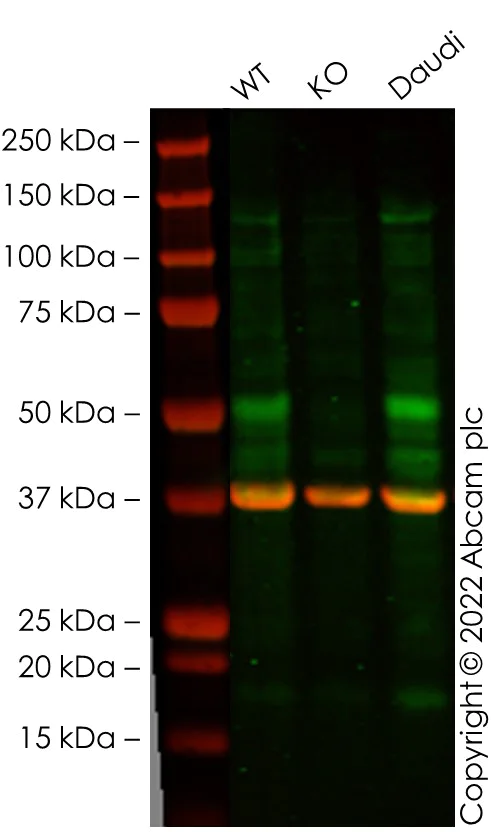 Western blot - Anti-CD79a antibody [EPR3619] (AB133483)