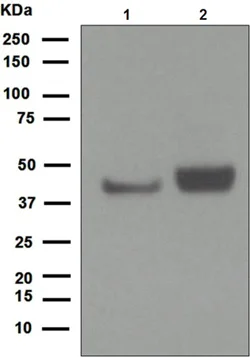 Western blot - Anti-CD79a antibody [EPR3619] - BSA and Azide free (AB248518)