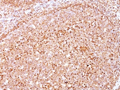 Immunohistochemistry (Formalin/PFA-fixed paraffin-embedded sections) - Anti-CD79a antibody [HM47/A9] (AB234019)