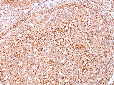 Immunohistochemistry (Formalin/PFA-fixed paraffin-embedded sections) - Anti-CD79a antibody [HM47/A9] - BSA and Azide free (AB213112), expandable thumbnail