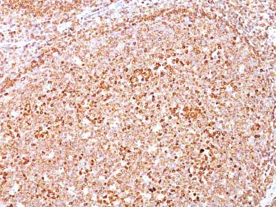 Immunohistochemistry (Formalin/PFA-fixed paraffin-embedded sections) - Anti-CD79a antibody [HM47/A9] - BSA and Azide free (AB213112)