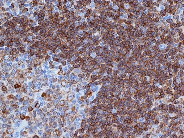 Immunohistochemistry (Formalin/PFA-fixed paraffin-embedded sections) - Anti-CD79a antibody [HM57] (AB62650)