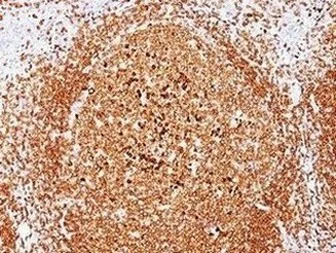 Immunohistochemistry (Formalin/PFA-fixed paraffin-embedded sections) - Anti-CD79a antibody [JCB117] (AB187269)