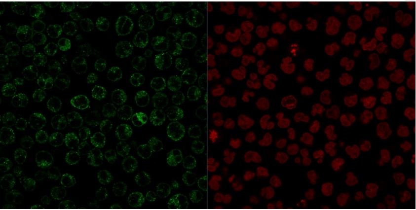 Immunocytochemistry - Anti-CD79a antibody [JCB117] - BSA and Azide free (AB213110), expandable thumbnail
