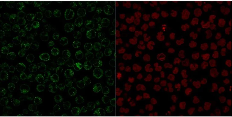 Immunocytochemistry - Anti-CD79a antibody [JCB117] - BSA and Azide free (AB213110)